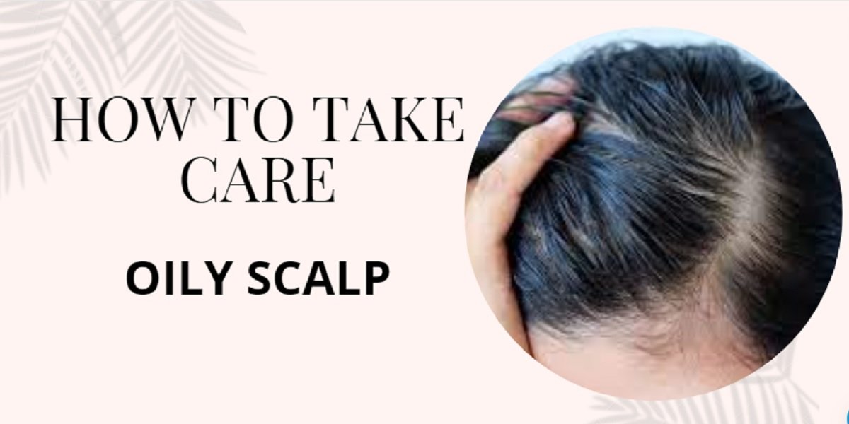 oily scalp